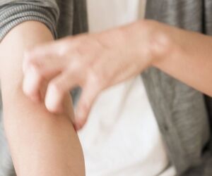Démangeaisons : 12 applications naturelles pour soulager votre peau