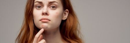 Les 5 effets néfastes du stress sur ma peau, au secours !