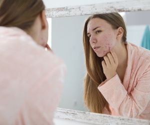 Acné à l’âge adulte, un complexe qui impacte la confiance en soi